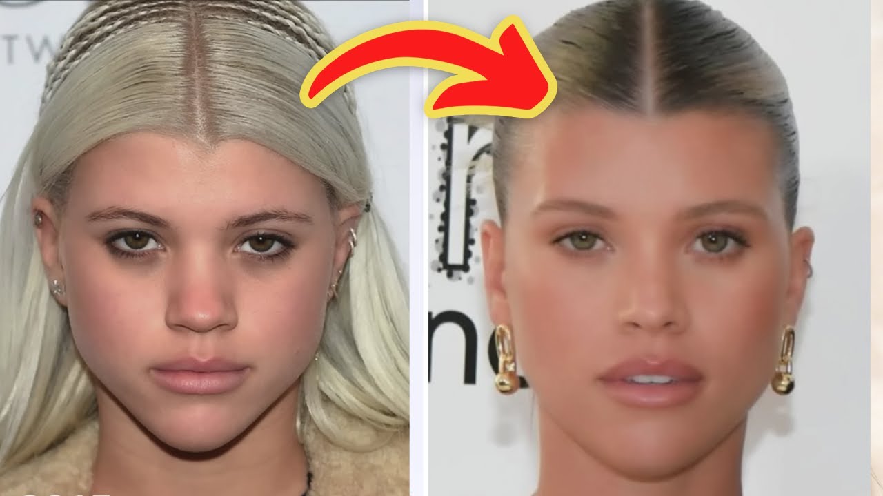 sofia richie nose job