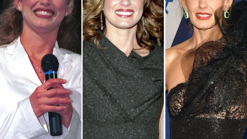 did faith hill have a facelift
