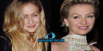 portia de rossi before and after