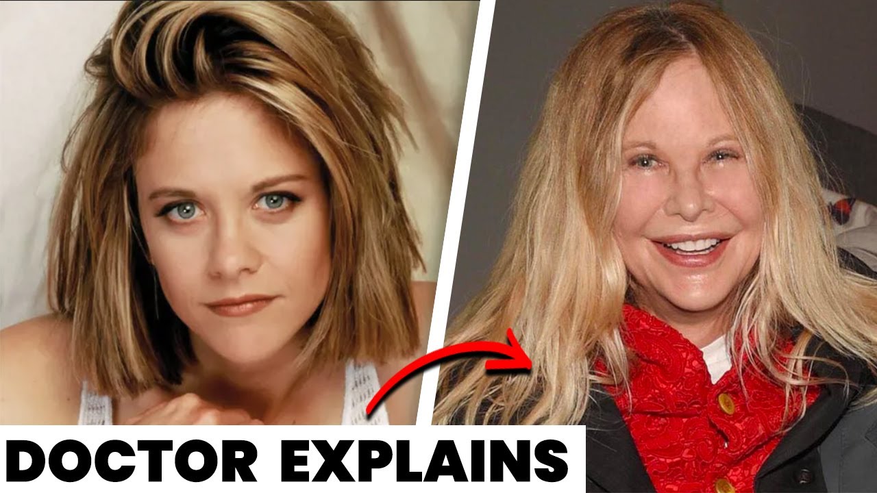 meg ryan and plastic surgery