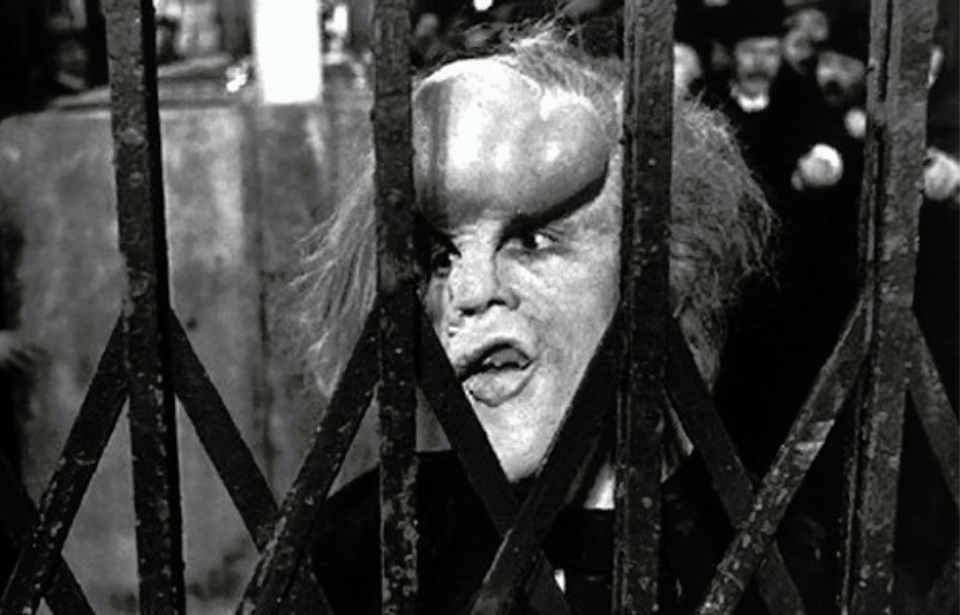 mel brooks elephant man