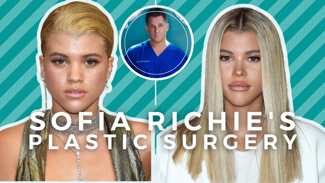 sofia richie nose job