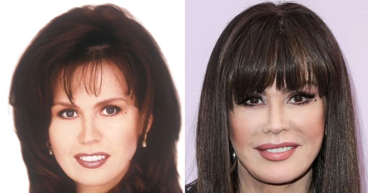 marie osmond facelift