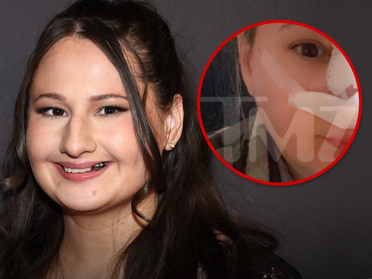 gypsy rose rhinoplasty