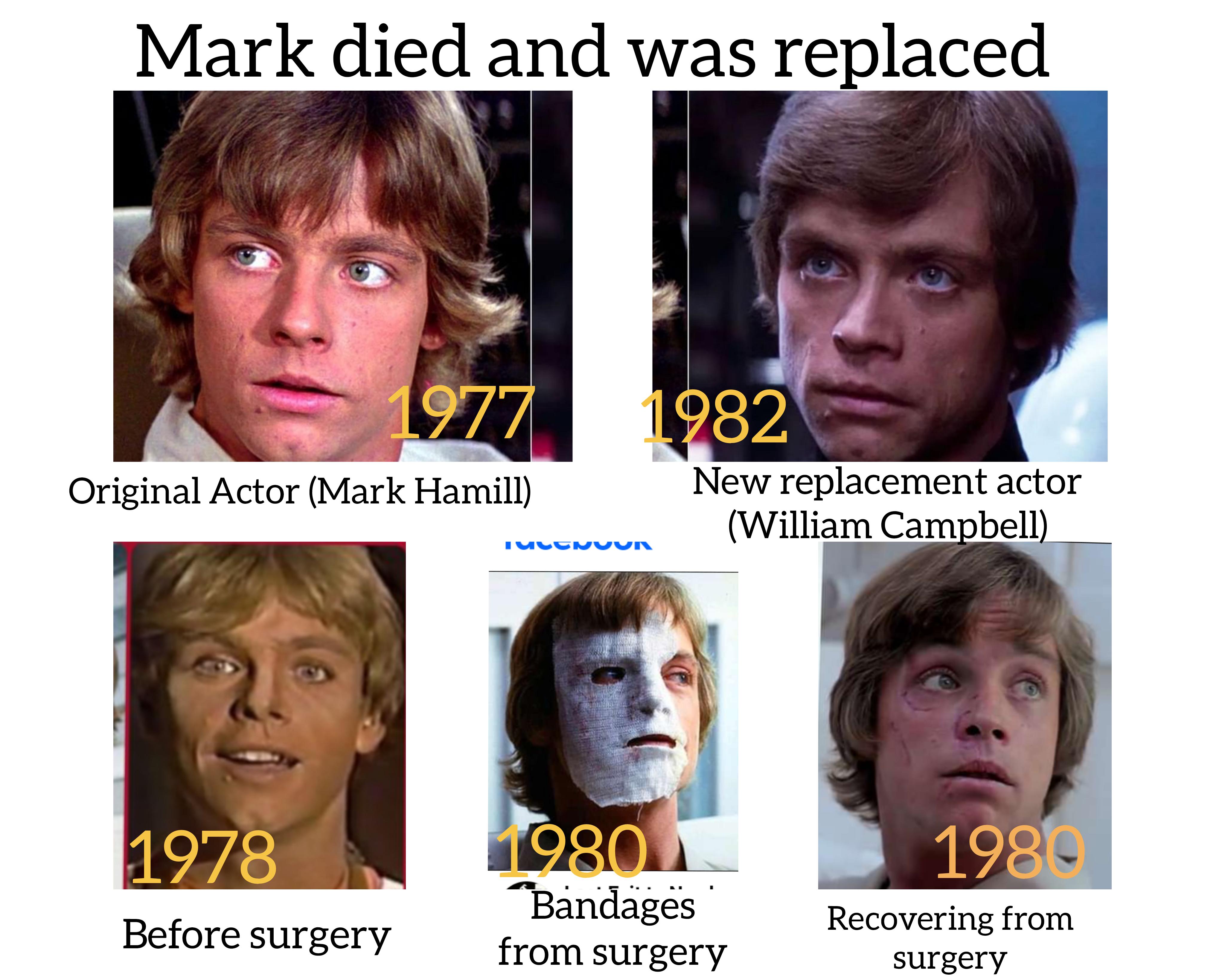 mark hamill car accident face