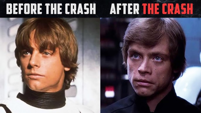mark hamill car accident face