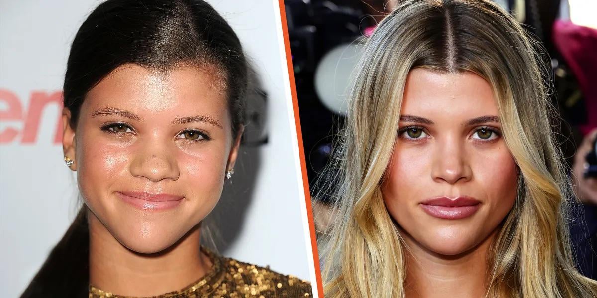 sofia richie nose job