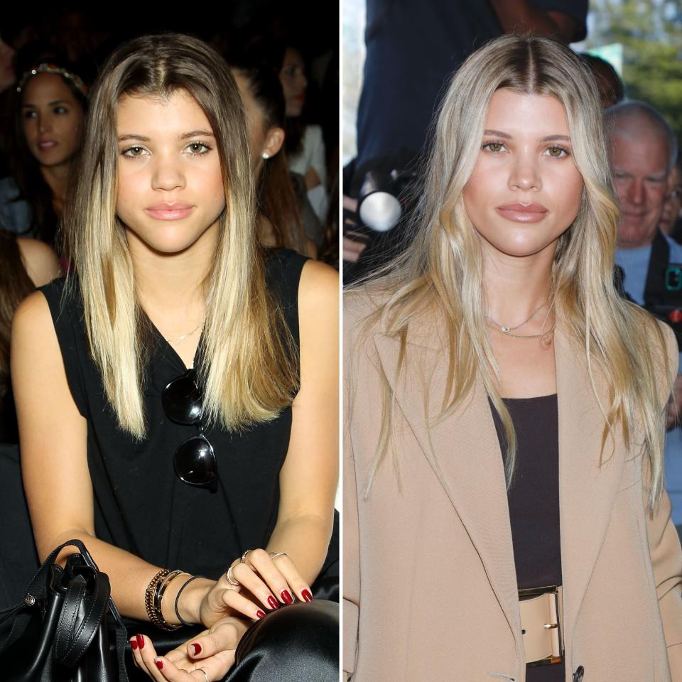 sofia richie nose job