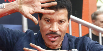 lionel richie botox