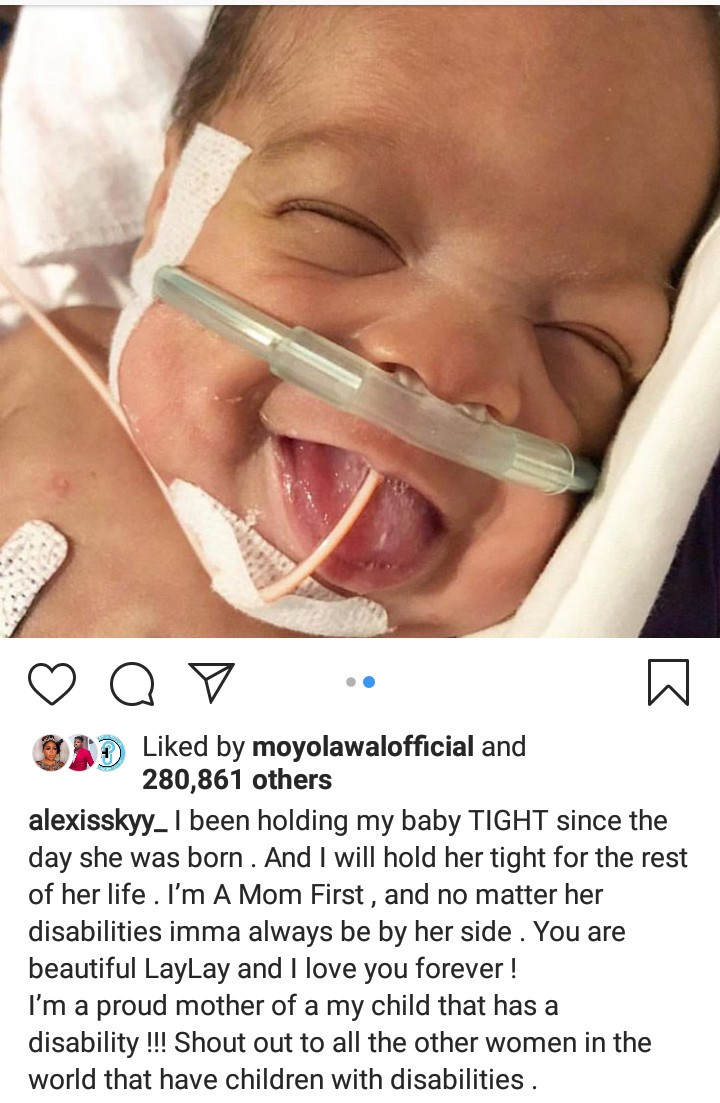 alexis sky baby condition
