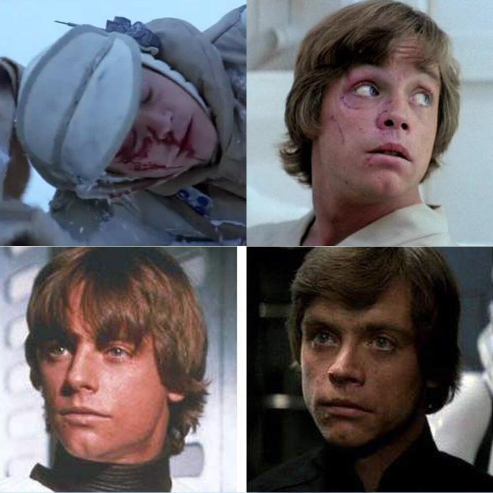 mark hamill car accident face