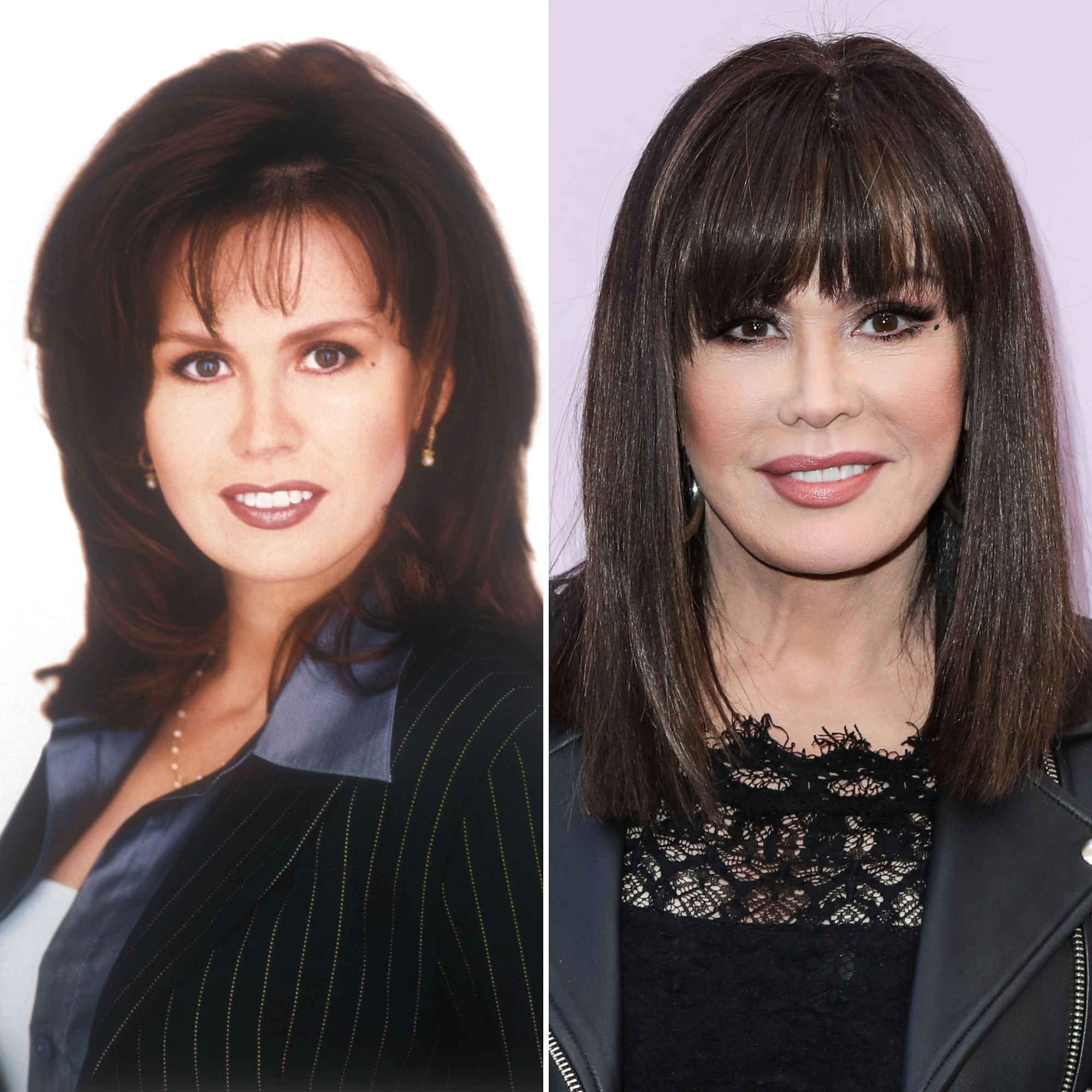 marie osmond facelift